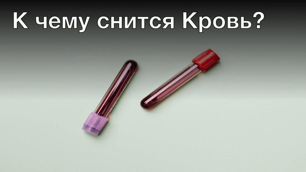 К Чему Снится Кровь: Толкования и Значение Кровавых Снов